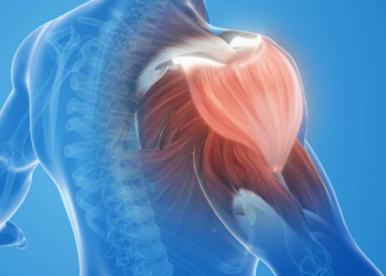 Rigidez muscular é o principal sintoma da síndrome de Stiff Person. Não há como evitar a síndrome, mas há doenças que podem predispor ao problema, por exemplo, diabete, hipotireoidismo, tireoidite, vitiligo e também a deficiência da vitamina B12 (Foto: Reprodução/Canva)