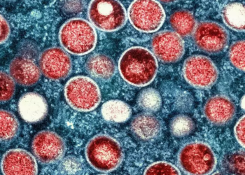 Brasil supera marca de mil casos de mpox em 2024