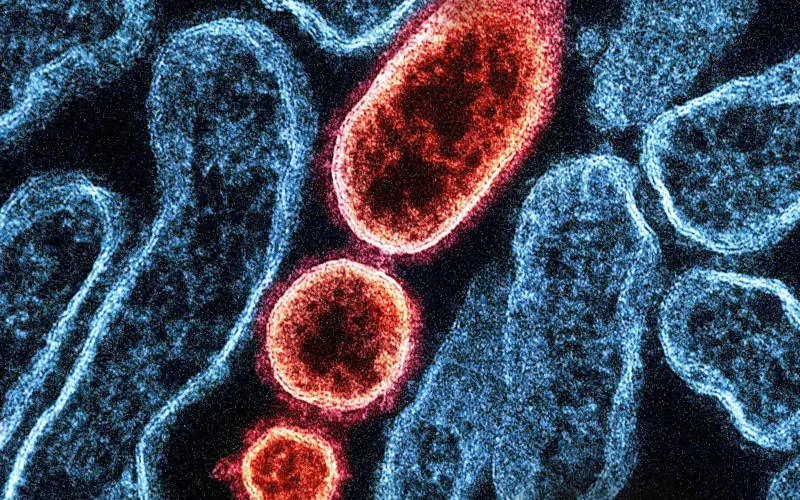 Vírus Nipah volta a preocupar saúde global após casos na Índia, mas sem cenário de novo surto