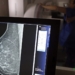 Entidades alertam médicos sobre pedidos de mamografia digital