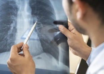 Anvisa aprova novo medicamento para câncer de pulmão avançado